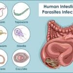 how to get rid of parasites in your body